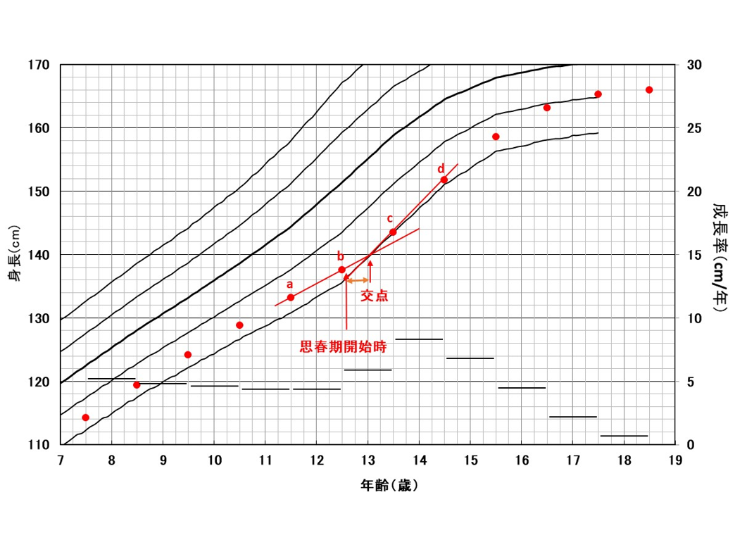 成長曲線